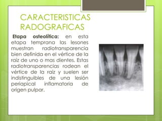 CARACTERISTICAS
   RADOGRAFICAS
 Etapa osteolítica: en esta
etapa temprana las lesones
muestran      radiotransparencia
bien definida en el vértice de la
raíz de uno o mas dientes. Estas
radiotransparencias rodean el
vértice de la raíz y suelen ser
indistinguibles de una lesión
periapical     inflamatoria   de
origen pulpar.
 