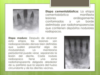 Etapa cementoblástica: La etapa
                              cementoblástica          manifiesta
                              lesiones            análogamente
                              conformadas      y    un    borde
                              delimitado por radiotransparencias
                              que contienen depósitos nodulares
                              radiopacos.

Etapa madura: Después de alcanzar
esta    etapa,      las  lesiones   son
radioopacidades densas bien definidas
que    suelen    presentar    algo    de
modularidad.          La     membrana
periodontal puede verse separando la
lesión del diente. Cada nodulo
radioopaco       tiene     una     zona
radiotransparente delgada alrededor
de su periferia que la separa del hueso
circundante y de los dientes vecinos.
 