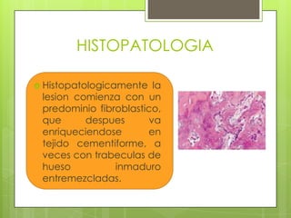 HISTOPATOLOGIA

 Histopatologicamente   la
 lesion comienza con un
 predominio fibroblastico,
 que      despues       va
 enriqueciendose       en
 tejido cementiforme, a
 veces con trabeculas de
 hueso          inmaduro
 entremezcladas.
 