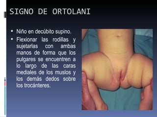 SIGNO DE ORTOLANI

 Niño en decúbito supino.
 Flexionar las rodillas y
  sujetarlas con ambas
  manos de forma que los
  pulgares se encuentren a
  lo largo de las caras
  mediales de los muslos y
  los demás dedos sobre
  los trocánteres.
 