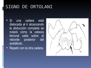 SIGNO DE ORTOLANI

 Si    una cadera está
  dislocada al ir alcanzando
  la abducción completa se
  notará cómo la cabeza
  femoral salta sobre el
  reborde posterior del
  acetábulo.
 Repetir con la otra cadera.
 