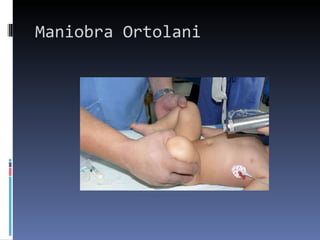Maniobra Ortolani
 