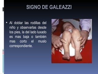 SIGNO DE GALEAZZI

 Al doblar las rodillas del
  niño y observarlas desde
  los pies, la del lado luxado
  es mas baja o también
  mas corto el muslo
  correspondiente.
 