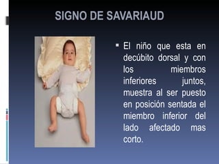 SIGNO DE SAVARIAUD

          El niño que esta en
           decúbito dorsal y con
           los          miembros
           inferiores      juntos,
           muestra al ser puesto
           en posición sentada el
           miembro inferior del
           lado afectado mas
           corto.
 
