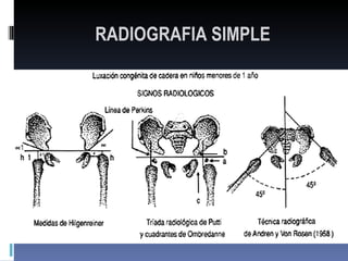 RADIOGRAFIA SIMPLE
 