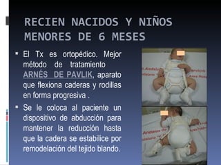 RECIEN NACIDOS Y NIÑOS
  MENORES DE 6 MESES
 El Tx es ortopédico. Mejor
  método de tratamiento
  ARNÉS DE PAVLIK, aparato
  que flexiona caderas y rodillas
  en forma progresiva .
 Se le coloca al paciente un
  dispositivo de abducción para
  mantener la reducción hasta
  que la cadera se estabilice por
  remodelación del tejido blando.
 