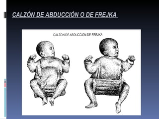 CALZÓN DE ABDUCCIÓN O DE FREJKA
 