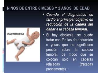 NIÑOS DE ENTRE 6 MESES Y 2 AÑOS DE EDAD
                 Cuando el diagnostico es
                  tardío el principal objetivo es
                  reducción de la cadera sin
                  dañar a la cabeza femoral.
                 Si hay displasia, se puede
                  tratar con férulas de abducción
                  o yesos que no signifiquen
                  presión sobre la cabeza
                  femoral, de modo que se
                  colocan sólo en caderas
                  relajadas              (tratadas
                  previamente).
 