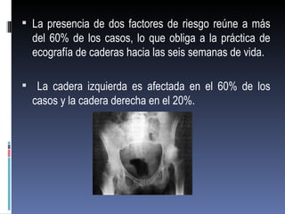  La presencia de dos factores de riesgo reúne a más
  del 60% de los casos, lo que obliga a la práctica de
  ecografía de caderas hacia las seis semanas de vida.

 La cadera izquierda es afectada en el 60% de los
  casos y la cadera derecha en el 20%.
 