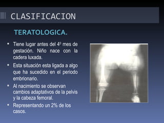 CLASIFICACION
   TERATOLOGICA.
 Tiene lugar antes del 40 mes de
  gestación. Niño nace con la
  cadera luxada.
 Esta situación esta ligada a algo
  que ha sucedido en el periodo
  embrionario.
 Al nacimiento se observan
  cambios adaptativos de la pelvis
  y la cabeza femoral.
 Representando un 2% de los
  casos.
 