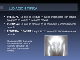 LUXACION TIPICA

 PRENATAL: La que se produce y puede evidenciarse por estudio
  ecográfico en los días o semanas previos.
 PERINATAL: La que se produce en el nacimiento o inmediatamente
  después.
 POSTNATAL O TARDIA: La que se produce en las semanas o meses
  después.

   Representan el 98% de los casos.
   Las manifestaciones clínicas al
   nacimiento son sutiles y las
   radiografías frecuentemente
   normales.
 