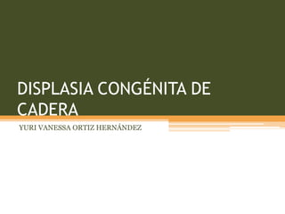 DISPLASIA CONGÉNITA DE
CADERA
YURI VANESSA ORTIZ HERNÁNDEZ
 