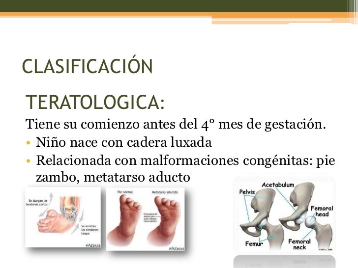 Para profesionales