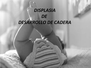 DISPLASIA DEL DESARROLLO DE  CADERA (displasia congénita de cadera) DISPLASIA DE  DESARROLLO DE CADERA 