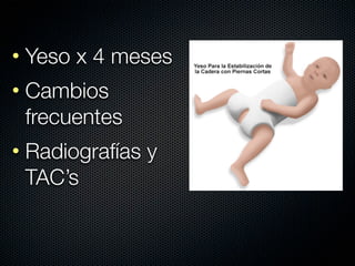 • Yeso x 4 meses
• Cambios
  frecuentes
• Radiografías y
  TAC’s
 