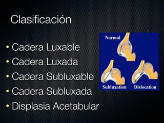 Clasiﬁcación

• Cadera Luxable
• Cadera Luxada
• Cadera Subluxable
• Cadera Subluxada
• Displasia Acetabular
 
