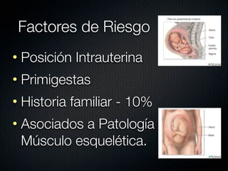 Factores de Riesgo
• Posición Intrauterina
• Primigestas
• Historia familiar - 10%
• Asociados a Patología
  Músculo esquelética.
 