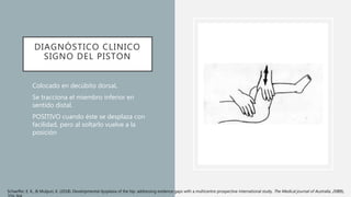 Displasia de cadera | PPTX