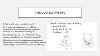 Displasia del desarrollo de cadera..pptx