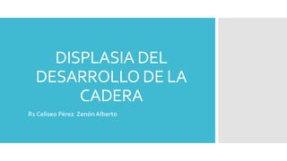 DISPLASIA DEL
DESARROLLO DE LA
CADERA
R1 Celiseo Pérez Zenón Alberto
 