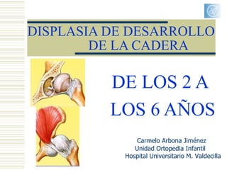 DISPLASIA DE DESARROLLO
        DE LA CADERA

          DE LOS 2 A
          LOS 6 AÑOS
                Carmelo Arbona Jiménez
               Unidad Ortopedia Infantil
            Hospital Universitario M. Valdecilla
 