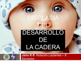 DISPLASIA
DEL
DESARROLLO
DE
LA CADERA
Jairo R R Rotación Lactantes – X
Semestre
 