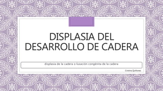 DISPLASIA DEL
DESARROLLO DE CADERA
displasia de la cadera o luxación congénita de la cadera
Cristina Quiñonez
 