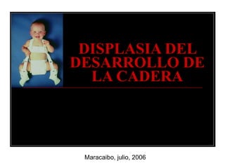 DISPLASIA DEL DESARROLLO DE LA CADERA MC. Marlene Patiño de C. RII SCOT-HUM-LUZ Maracaibo, julio, 2006 