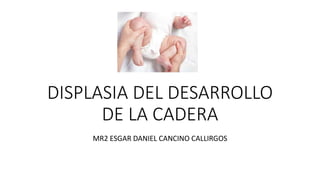 DISPLASIA DEL DESARROLLO
DE LA CADERA
MR2 ESGAR DANIEL CANCINO CALLIRGOS
 