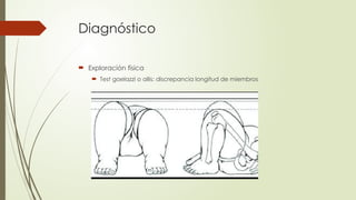 Displasia del desarrollo de la cadera.pptx