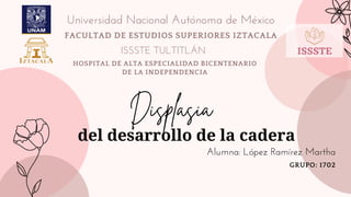 del desarrollo de la cadera
Displasia
FACULTAD DE ESTUDIOS SUPERIORES IZTACALA
Universidad Nacional Autónoma de México
HOSPITAL DE ALTA ESPECIALIDAD BICENTENARIO
DE LA INDEPENDENCIA
ISSSTE TULTITLÁN
GRUPO: 1702
Alumna: López Ramírez Martha
 