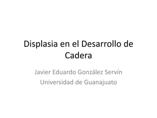 Displasia en el Desarrollo de
Cadera
Javier Eduardo González Servín
Universidad de Guanajuato
 