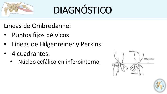 Los blogs como aumentar el miembro