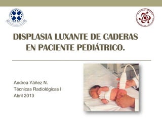 DISPLASIA LUXANTE DE CADERAS
EN PACIENTE PEDIÁTRICO.
Andrea Yáñez N.
Técnicas Radiológicas I
Abril 2013
 