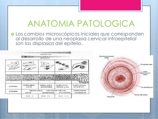 Displasias o nic