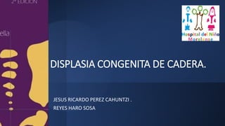 DISPLASIA CONGENITA DE CADERA.
JESUS RICARDO PEREZ CAHUNTZI .
REYES HARO SOSA
 