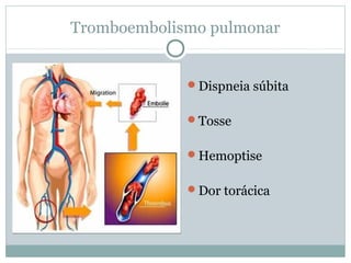 Tromboembolismo pulmonar
Dispneia súbita
Tosse
Hemoptise
Dor torácica
 