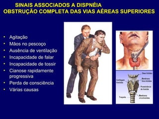 SINAIS ASSOCIADOS A DISPNÉIASINAIS ASSOCIADOS A DISPNÉIA
OBSTRUÇÃO COMPLETA DAS VIAS AÉREAS SUPERIORESOBSTRUÇÃO COMPLETA DAS VIAS AÉREAS SUPERIORES
• AgitaçãoAgitação
• Mãos no pescoçoMãos no pescoço
• Ausência de ventilaçãoAusência de ventilação
• Incapacidade de falarIncapacidade de falar
• Incapacidade de tossirIncapacidade de tossir
• Cianose rapidamenteCianose rapidamente
progressivaprogressiva
• Perda de consciênciaPerda de consciência
• Várias causasVárias causas
 