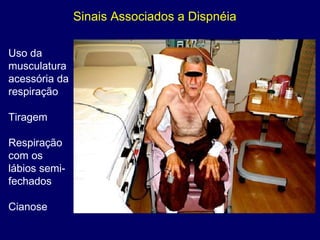 Sinais Associados a Dispnéia
Uso da
musculatura
acessória da
respiração
Tiragem
Respiração
com os
lábios semi-
fechados
Cianose
 
