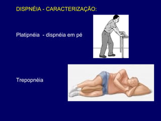 DISPNÉIA - CARACTERIZAÇÃO:
Platipnéia - dispnéia em pé
Trepopnéia
 