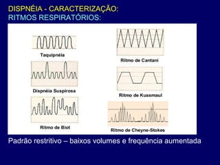 DISPNÉIA - CARACTERIZAÇÃO:
RITMOS RESPIRATÓRIOS:
Padrão restritivo – baixos volumes e frequência aumentada
 