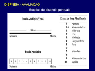 Escalas de dispnéia pontuais
DISPNÉIA - AVALIAÇÃO
 