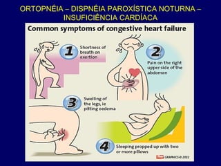 ORTOPNÉIA – DISPNÉIA PAROXÍSTICA NOTURNA –
INSUFICIÊNCIA CARDÍACA
 