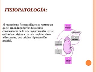 FISIOPATOLOGÍA:


El mecanismo fisiopatológico se resume en
que el riñón hipoperfundido como
consecuencia de la estenosis vascular renal
estimula el sistema renina- angiotensina-
aldosterona, que origina hipertensión
arterial.
 
