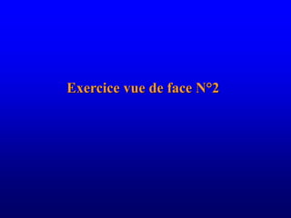 Exercice vue de face N°2
 