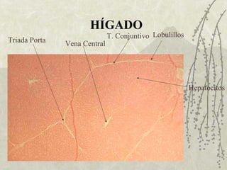 HÍGADO Lobulillos Triada Porta Vena Central T. Conjuntivo Hepatocitos 