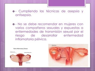  - Cumpliendo las técnicas de asepsia y
antisepsia.
 - No se debe recomendar en mujeres con
varios compañeros sexuales y expuestas a
enfermedades de transmisión sexual por el
riesgo de desarrollar enfermedad
inflamatoria pélvica.
 