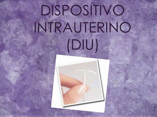DISPOSITIVO
INTRAUTERINO
(DIU)
 