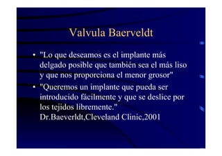 Valvula Baerveldt
• "Lo que deseamos es el implante más
delgado posible que también sea el más liso
y que nos proporciona el menor grosor"
• "Queremos un implante que pueda ser
introducido fácilmente y que se deslice por
los tejidos libremente."
Dr.Baeverldt,Cleveland Clinic,2001
 