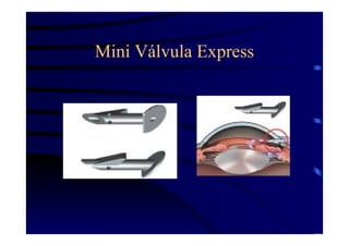 Mini Válvula Express
 